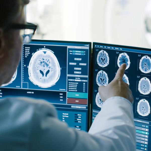a person points to images of scans on a computer screen